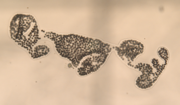 Microcystis남조류 사진