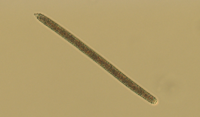 Oscillatoria남조류 사진