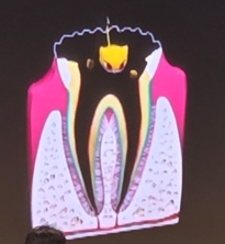 번쩍번쩍 건강한 치아 왕을 찾아라! 제68회 부산광역시 건치아동 선발대회 대표이미지