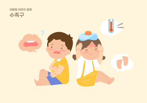손·발·입에 콕콕 물집이? 여름철 유행하는 ‘수족구병’ 조심해!