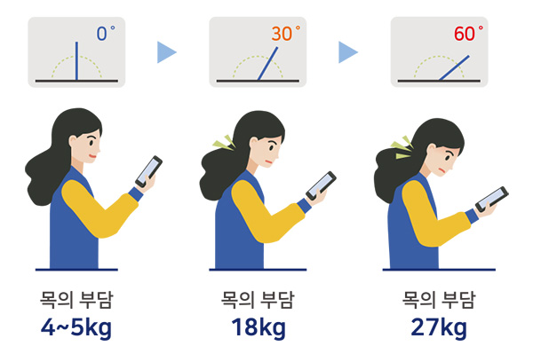 0도 : 목의 부담 4~5kg
30도 : 목의 부담 18kg
60도 : 목의 부담 27g