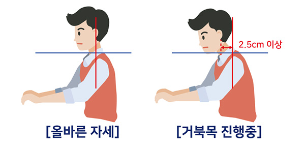 일직선일때 올바른자세, 2.5cm이상 차이나면 거북목 진행중