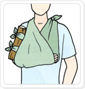 상박골 골절 응급처치 이미지 - 삼각건으로 팔걸이를 만들어 목에 걸어 준다.