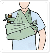 상박골 골절 응급처치 이미지 - 삼각건으로 팔 전체를 가슴에 묶어 고정 시킨다.