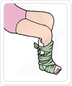 발등 뼈 골절 또는 염좌 응급처치 이미지